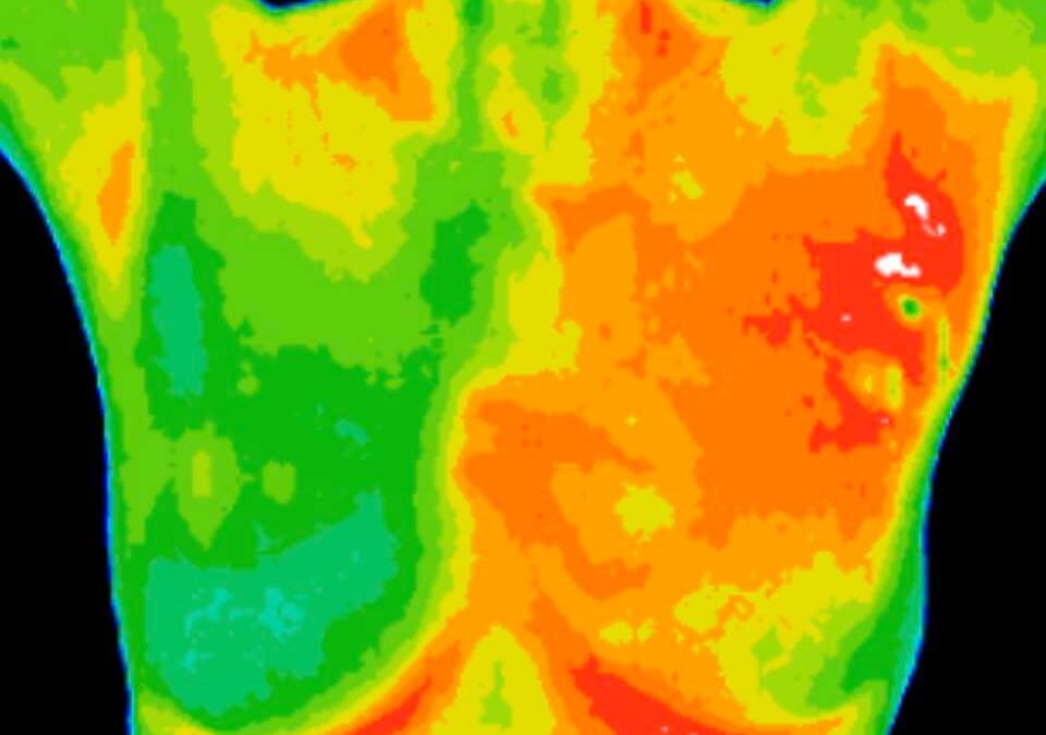 Thermography for Breast Health